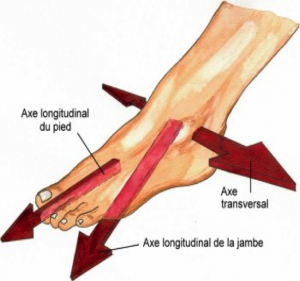 arthrose de la cheville 3