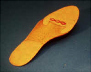 arthrose de la cheville 9